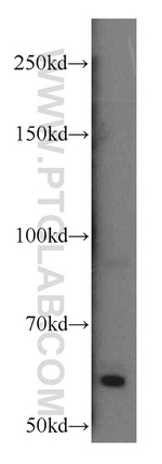 Calcium Sensing Receptor Antibody in Western Blot (WB)