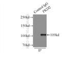 Polycystin 2 Antibody in Immunoprecipitation (IP)