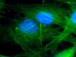 Polycystin 2 Antibody in Immunocytochemistry (ICC/IF)