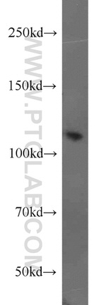 Polycystin 2 Antibody in Western Blot (WB)