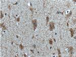 PKC delta Antibody in Immunohistochemistry (Paraffin) (IHC (P))