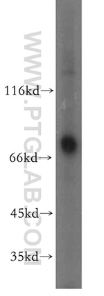 PKC delta Antibody in Western Blot (WB)