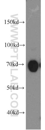 PKC delta Antibody in Western Blot (WB)