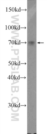 PKC delta Antibody in Western Blot (WB)