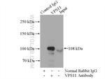 VPS11 Antibody in Immunoprecipitation (IP)