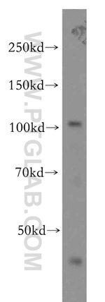 VPS11 Antibody in Western Blot (WB)