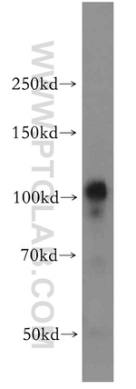 VPS11 Antibody in Western Blot (WB)