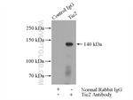 Tie2 Antibody in Immunoprecipitation (IP)