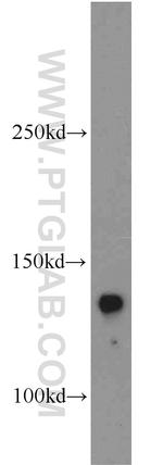 Tie2 Antibody in Western Blot (WB)