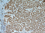 PSMB5 Antibody in Immunohistochemistry (Paraffin) (IHC (P))