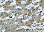 PSMB5 Antibody in Immunohistochemistry (Paraffin) (IHC (P))