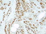 PSMB5 Antibody in Immunohistochemistry (Paraffin) (IHC (P))