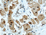 PSMB5 Antibody in Immunohistochemistry (Paraffin) (IHC (P))