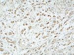 PSMB5 Antibody in Immunohistochemistry (Paraffin) (IHC (P))