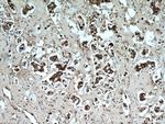 PSMB5 Antibody in Immunohistochemistry (Paraffin) (IHC (P))