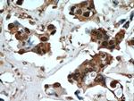 PSMB5 Antibody in Immunohistochemistry (Paraffin) (IHC (P))