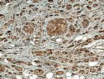 PSMB5 Antibody in Immunohistochemistry (Paraffin) (IHC (P))