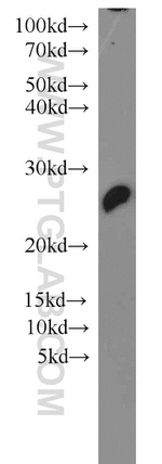 PSMB5 Antibody in Western Blot (WB)