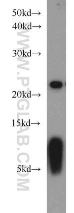 PSMB5 Antibody in Western Blot (WB)