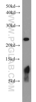 PSMB5 Antibody in Western Blot (WB)