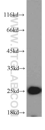 PSMB5 Antibody in Western Blot (WB)