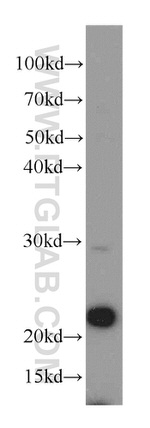 PSMB5 Antibody in Western Blot (WB)