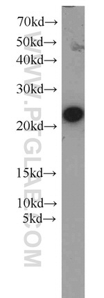 PSMB5 Antibody in Western Blot (WB)