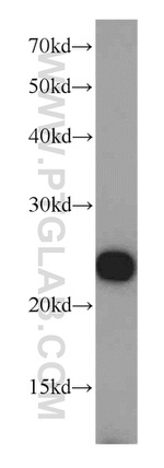 PSMB5 Antibody in Western Blot (WB)