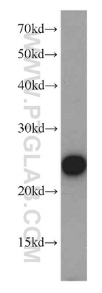 PSMB5 Antibody in Western Blot (WB)