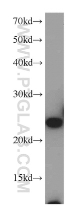 PSMB5 Antibody in Western Blot (WB)