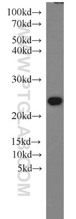 PSMB5 Antibody in Western Blot (WB)