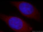 NAT1 Antibody in Immunocytochemistry (ICC/IF)