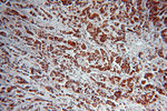 NAT1 Antibody in Immunohistochemistry (Paraffin) (IHC (P))