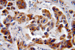 NAT1 Antibody in Immunohistochemistry (Paraffin) (IHC (P))