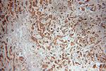 NAT1 Antibody in Immunohistochemistry (Paraffin) (IHC (P))