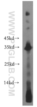 NAT1 Antibody in Western Blot (WB)