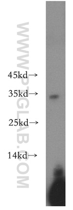 NAT1 Antibody in Western Blot (WB)