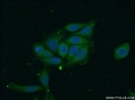 WDR45 Antibody in Immunocytochemistry (ICC/IF)