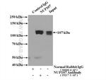 NUP107 Antibody in Immunoprecipitation (IP)