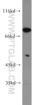 SKIL Antibody in Western Blot (WB)