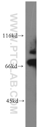 SKIL Antibody in Western Blot (WB)