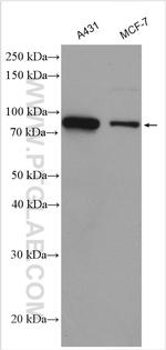 SKIL Antibody in Western Blot (WB)