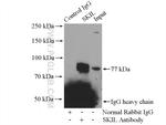 SKIL Antibody in Immunoprecipitation (IP)