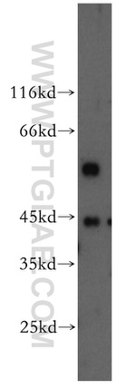 DNMT2 Antibody in Western Blot (WB)