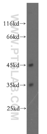 DNMT2 Antibody in Western Blot (WB)