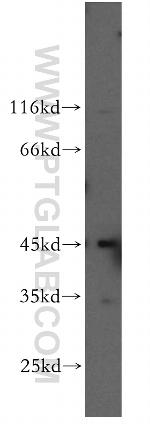 DNMT2 Antibody in Western Blot (WB)