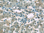CD39/ENTPD1 Antibody in Immunohistochemistry (Paraffin) (IHC (P))
