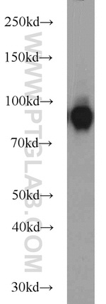 CD39/ENTPD1 Antibody in Western Blot (WB)