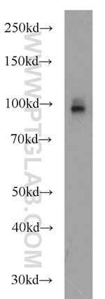 CD39/ENTPD1 Antibody in Western Blot (WB)