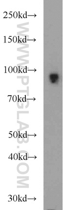 CD39/ENTPD1 Antibody in Western Blot (WB)